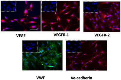 Testing calpain inhibition in tumor endothelial cells: novel targetable biomarkers against glioblastoma malignancy